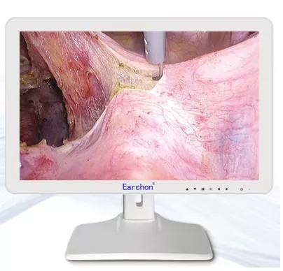 Hệ Camera Nội Soi HD